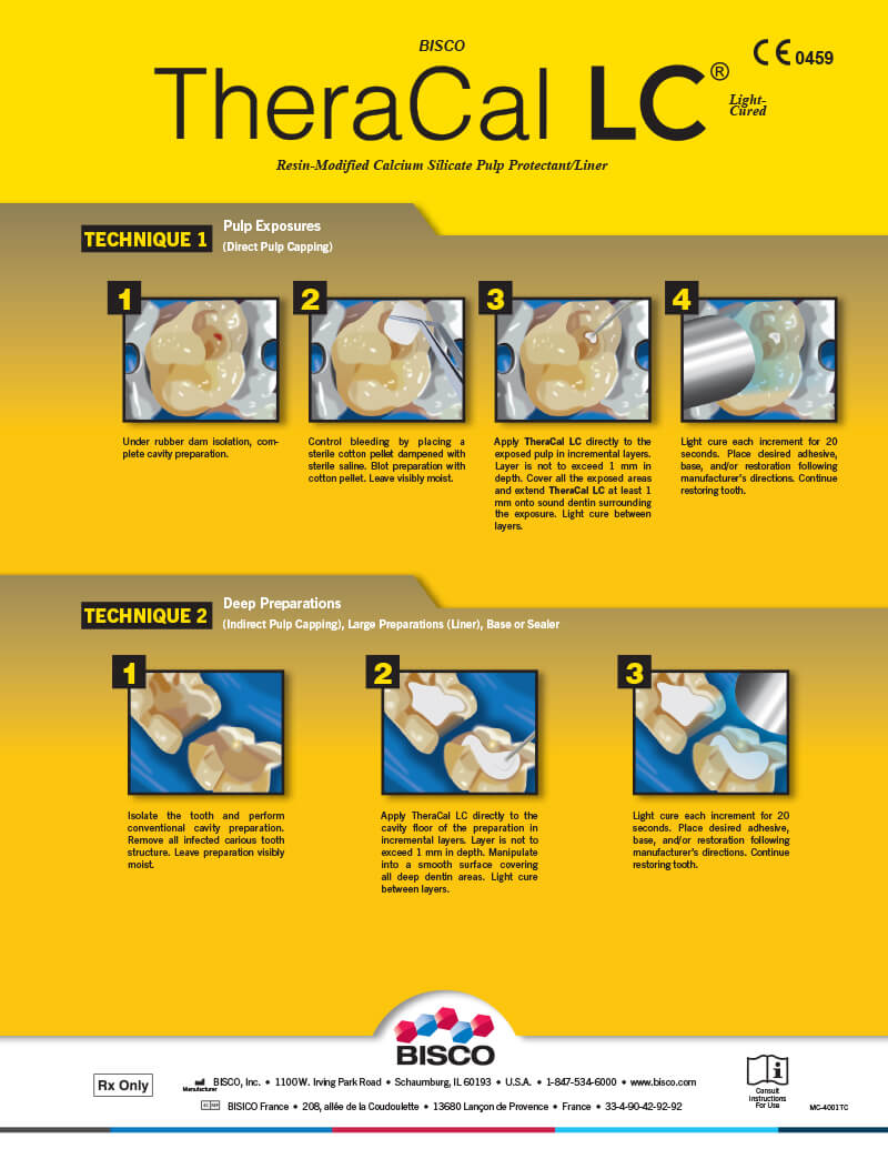TheraCal LC Technique Card